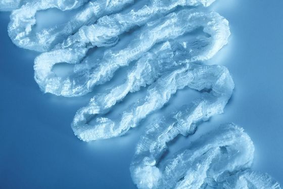 Hochgeschwindigkeitsfilter, der Azetat-Schleppseil der Maschinen-4.0Y 32000 mit Feuchtigkeit macht
